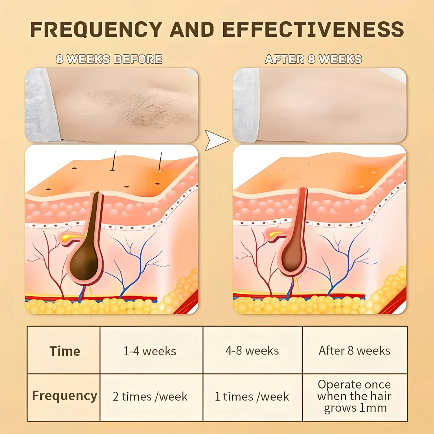 Depiladora Láser Eléctrica